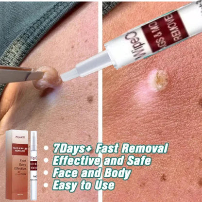 Essence(stylo) pour enlever des acrochordons, taches et grains de beauté.