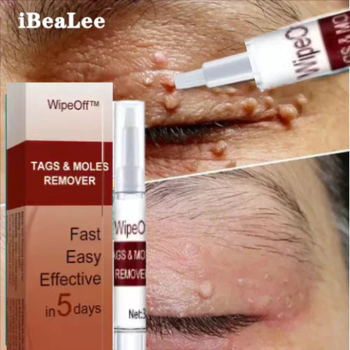 Essence(stylo) pour enlever des acrochordons, taches et grains de beauté.
